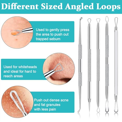 MAYCREATE® Blackhead Remover Tool Kit Pore Cleaning Tools, 15pcs Stainless Steel Blackhead Remover Tool Kit for Pimples, Blackheads, Whiteheads, Zit, Deep Pore Cleaning Tool with Storage Box MAYCREATE® Blackhead Remover Tool Kit Pore Cleaning Tools, 15pcs Stainless Steel Blackhead Remover Tool Kit for Pimples, Blackheads, Whiteheads, Zit, Deep Pore Cleaning Tool with Storage Box